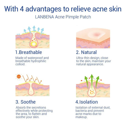 LANBENA Repair Acne Patch Facial Skin Care Fade Blemishes Pimple Marks Closed Acne Blemishes Cover Acne Pimple Repair Patch