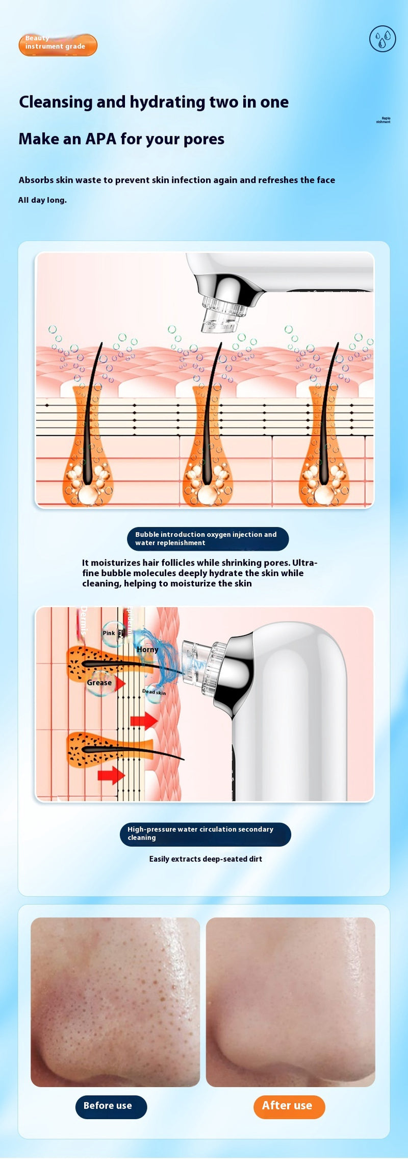 Electric Blackhead Removing Facial Pores Cleaner