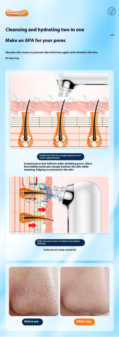 Electric Blackhead Removing Facial Pores Cleaner